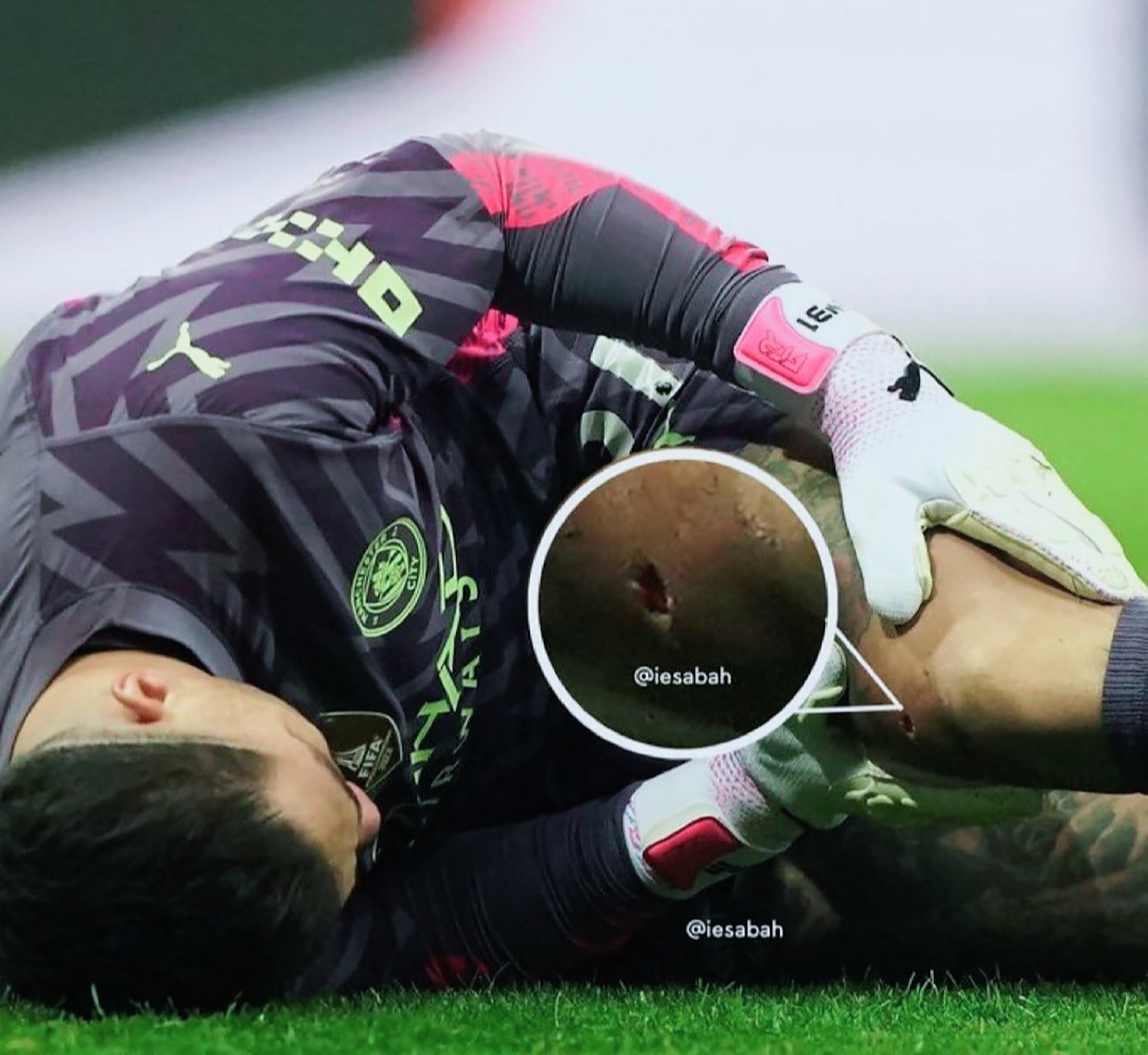 爱尔兰球员在比赛中受伤被紧急送医的简单介绍 爱尔兰球员在比赛中受伤被紧急送医的简单介绍